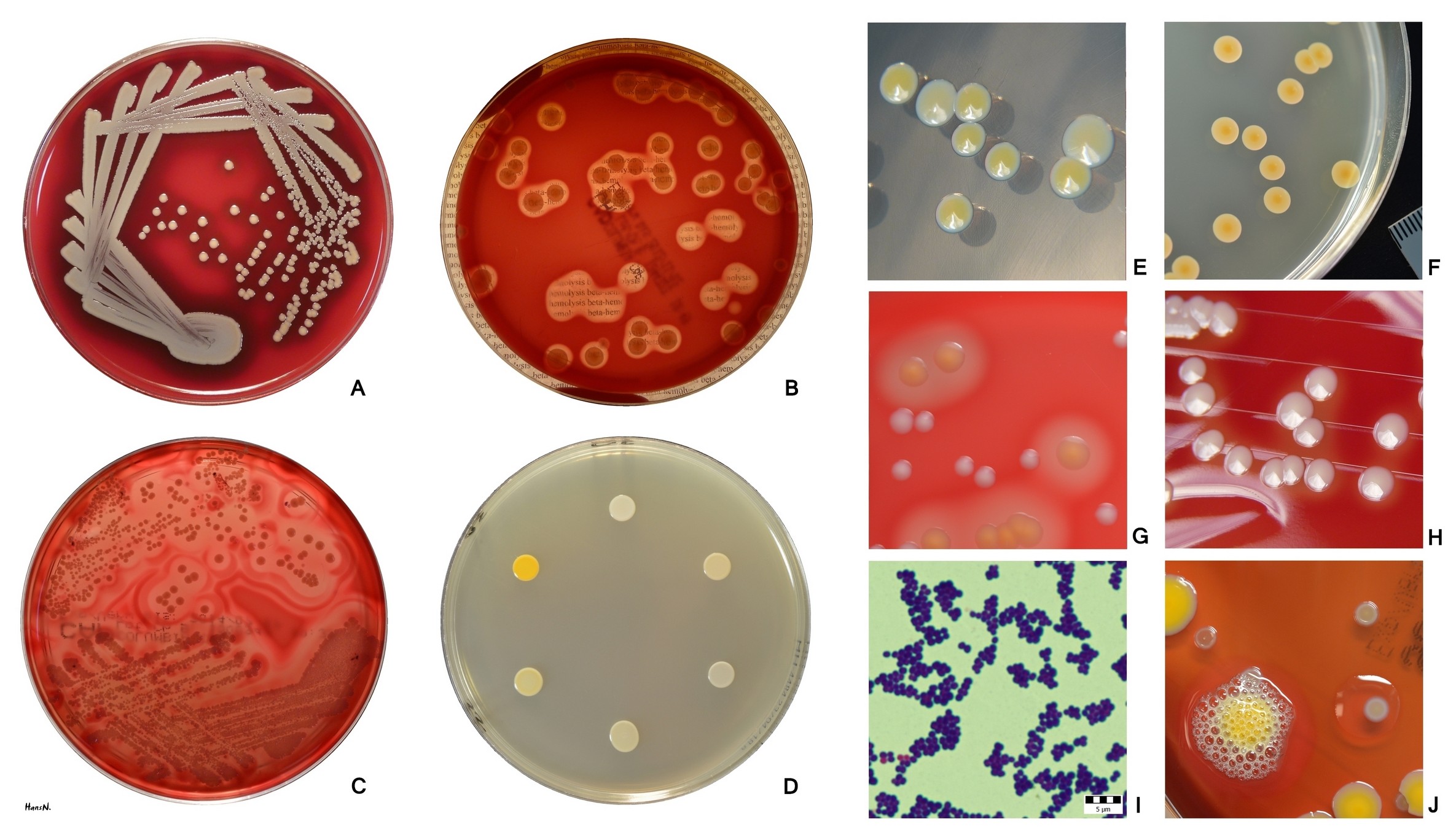 Man's 'Lucky Gi' Has Been Washed 11 Times In 14 Months — Lab Results Identify Three Bacterial Colonies Not Previously Known To Science